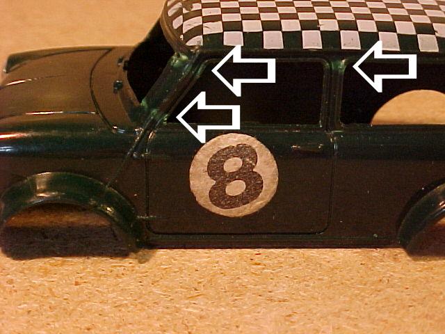 Side of body